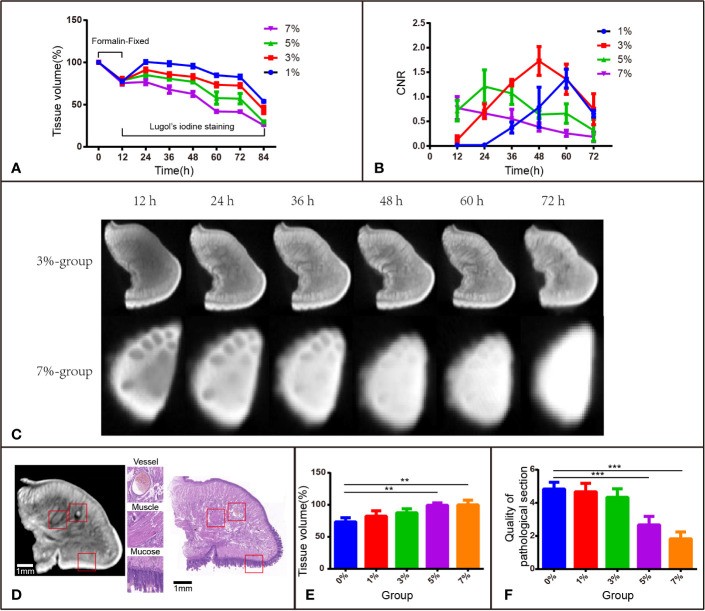 Lugol's Iodine-enhanced micro-CT: a potential 3-D imaging method for detecting tongue squamous cell carcinoma specimens in surgery